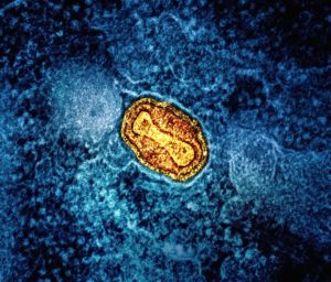 La vie sur Mars, L-sérieuse affaire ?